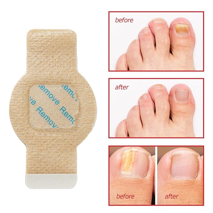 63 PCS Nail Patches, Toenail Treatment Extra Strength 8-Hour Overnight Nail Fast Acting Repair Effortless Hydrogel Nail Care and Repair for Damaged Nails Overnight Renewal for Men and Women