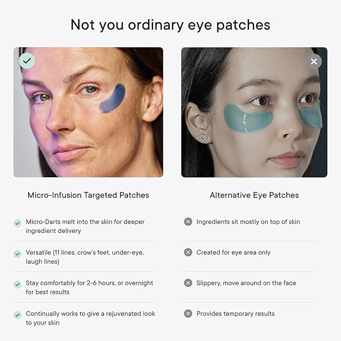 Qure Micro-Infusion Anti Wrinkle Patches for Smile Line, Frown lines, Under Eye Bags, Puffiness, Crow's Feet - Retinol, Caffeine - Dissolvable for Overnight Use - 8 Pairs