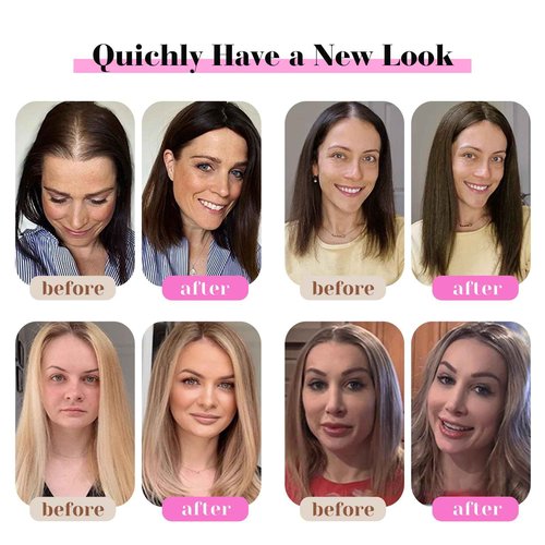 GULALUUK Hair Toppers for Women Real Human Hair 10 Inch Upgrade Swiss Lase Base Toppers Hairpieces with Thinning for Daily Wear (Ombre Light Blonde)