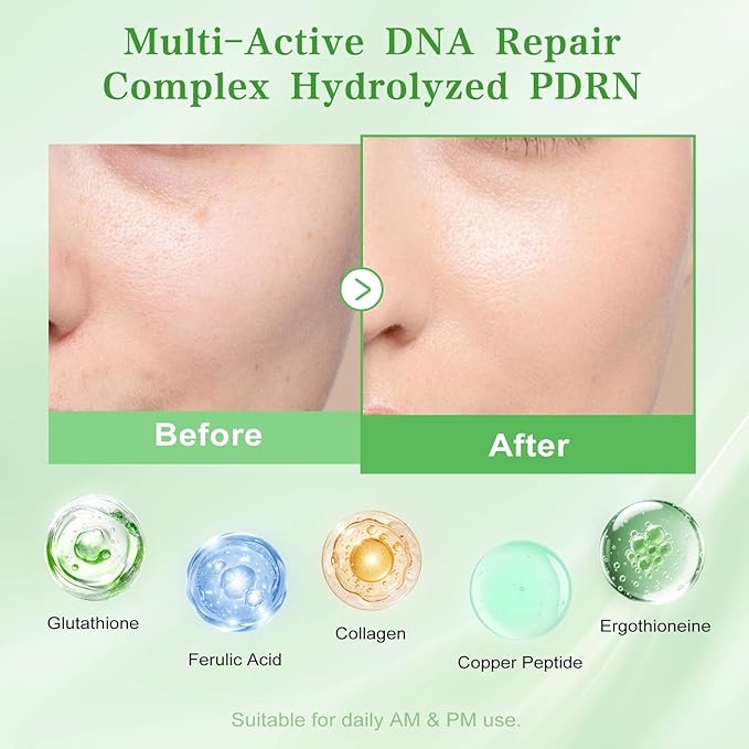 Liposomal Hydrolyzed Salmon DNA PDRN Anti-Aging Serum, Absorption Breakthrough Technology, 10,000ppm PDRN & Hyaluronic Acid, Copper Peptide 3000 ppm, Deep Hydration & Firming (0.05 fl.oz × 30e)