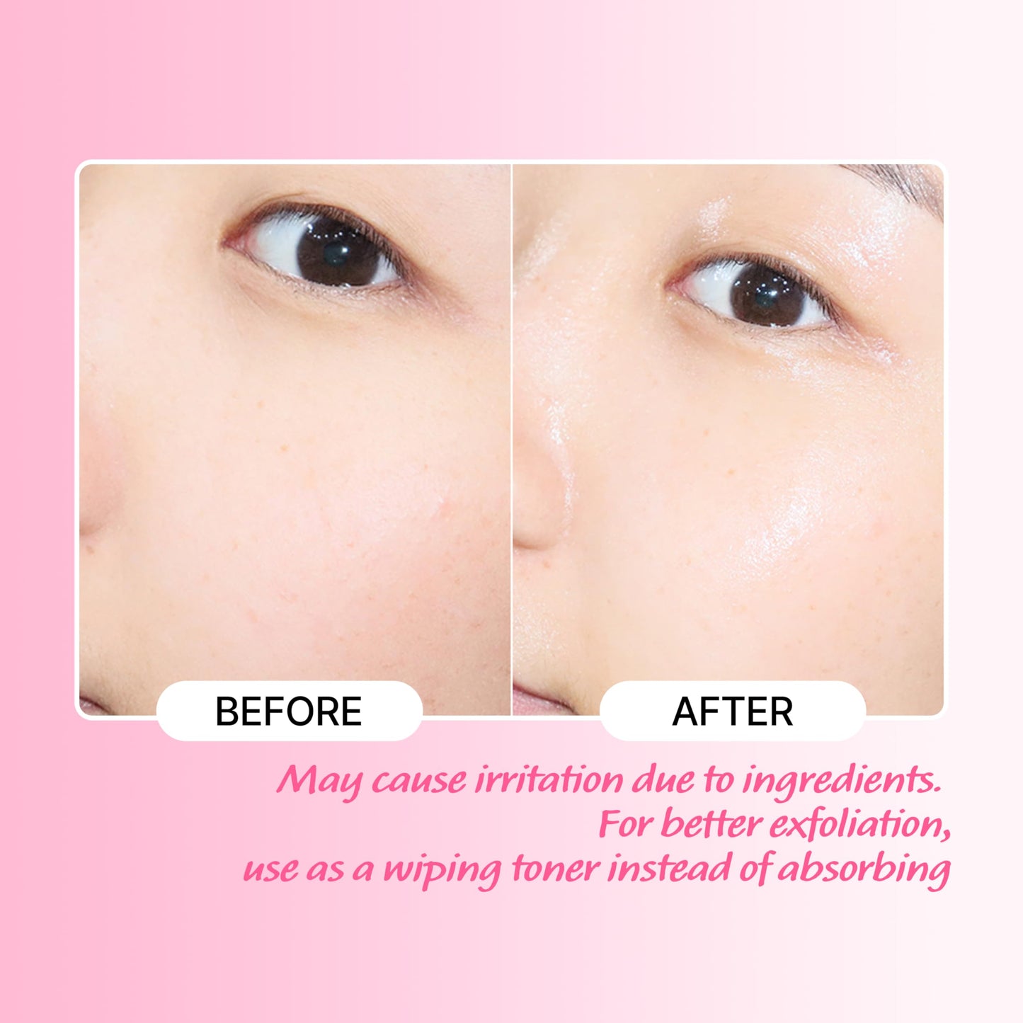 TOUCH IN SOL No Poreblem AHA BHA PHA Toner - Glycolic & Salicylic Acid Liquid Exfoliator - Makeup Prep & Pore Cleanser - Exfolia