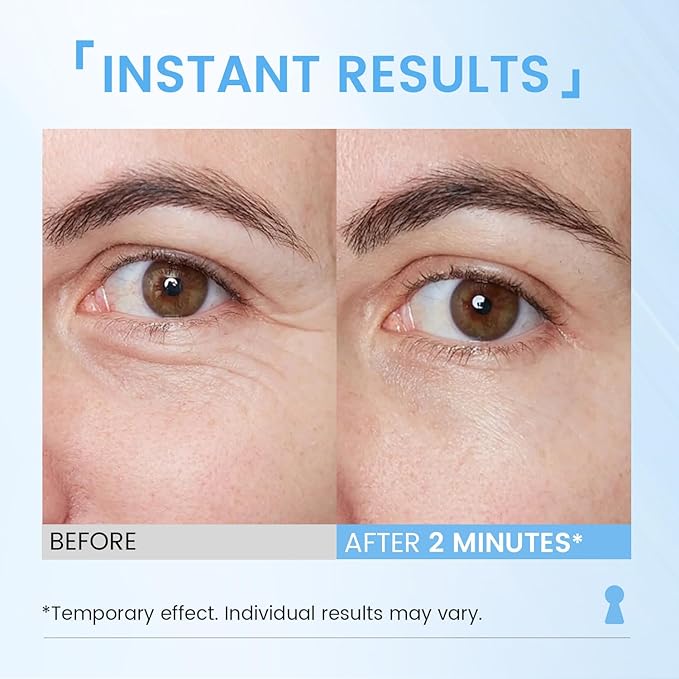Instant Eye Face Lift Cream: Reduces Eye Bags Wrinkles Puffy Eyes Dark Circles Crow’s Feet in Minutes for Mature Skin of Middle-aged Women 1 Fl Oz