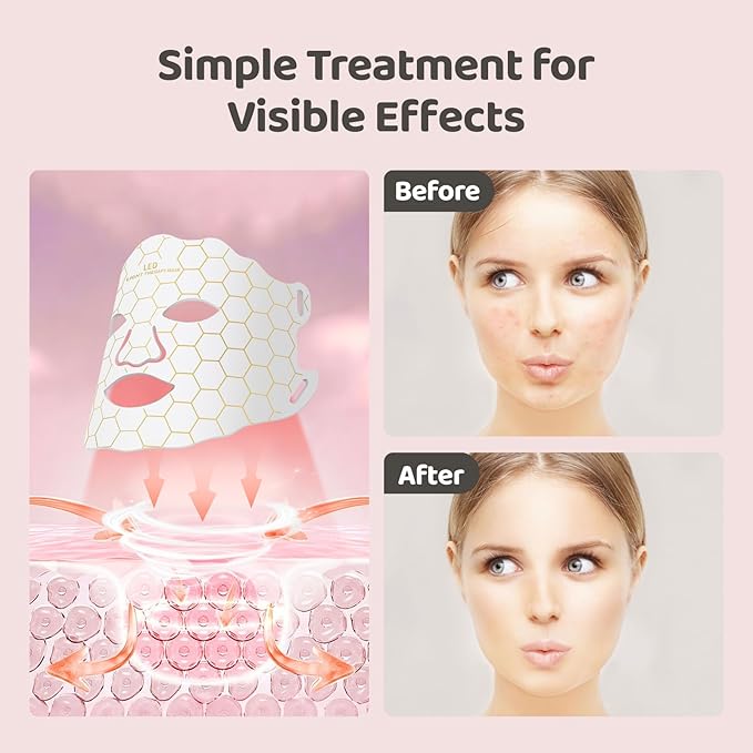 Yahi Red Light Photon Facial & Neck Mask with Remote Control, 7 Custom Modes with Infrared, Portable & Rechargeable with Timer for Home Use, 175 High-Density Light Beads, White