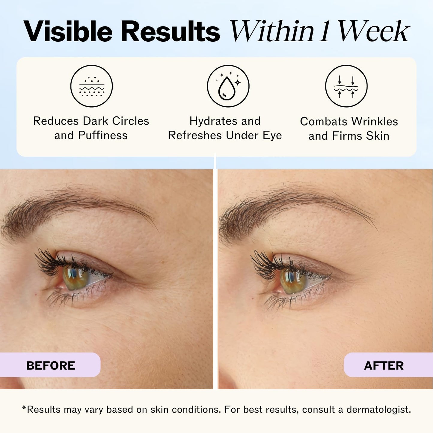 LilyAna Naturals Eye Cream for Dark Circles and Puffiness, Under Eye Cream for Wrinkles and Bags, Anti Aging - helps Improve Dry