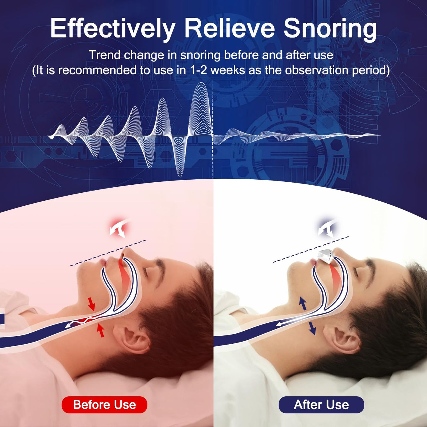 Anti Snoring Devices, Adjustable Wind Speed Snoring Solution, Electric Anti Snore Reduction Device Aids Nose Vents Plugs for Men & Women(White)-1