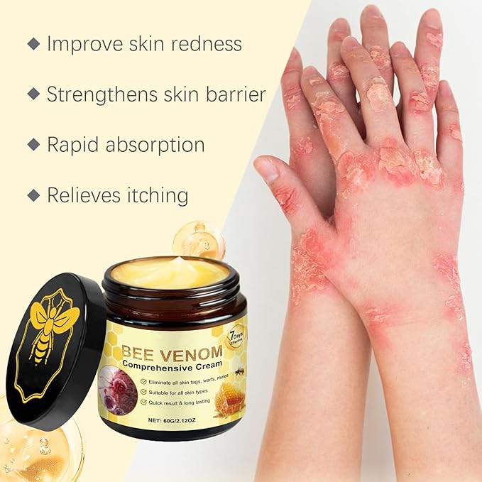 Bee Venom Comprehensive Cream, Bee Venom Skin Treatment Cream, All-in-One, Lifting & Firming, Anti-Aging Moisturizing, Effectively reduces all types of skin blemishes (2pcs)
