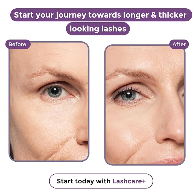 LashCare+ Eyelash Enhancing Serum For Older Women - Longer, Thicker Lashes in 12 Weeks - For Sensitive Eyes, Natural Growth - Enhancement, Conditioner for Longer-Looking Lashes (1mL (1 Month Supply))