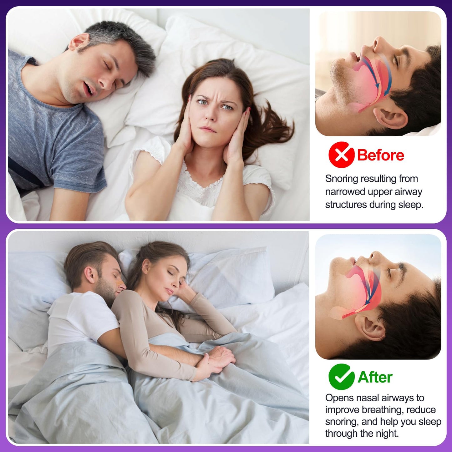 ZenithHome Nasal Strips for Snoring, 100 Count Extra Strength Nose Strips for Breathing, Anti Snoring Devices for Sports and Sleep, Help Stop Snoring, Relieve Nasal Congestion, Drug-Free,Deeper Sleep