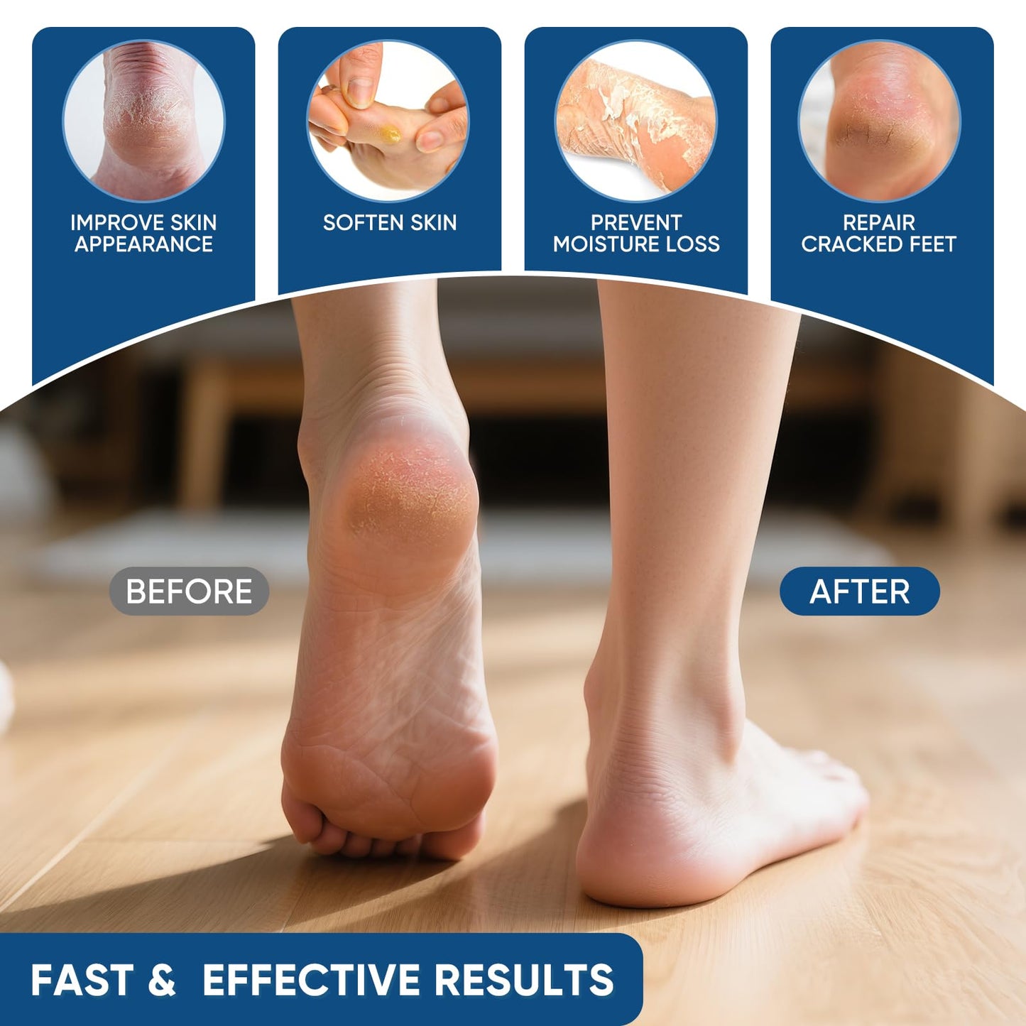 VREKEF Urea Cream 40% Plus Salicylic Acid 2%, Urea Cream 40 Percent for Feet Maximum Strength, Foot Cream for Dry Heels Cracked