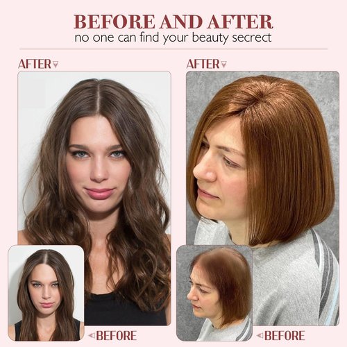 S-noilite Hair Toppers for Women 100% Real Human Hair, 10x12 Upgrade Base Ombre Light Blonde Remy HairToppers for Women with no Bangs 10inch 35g #Ombre Light Blonde