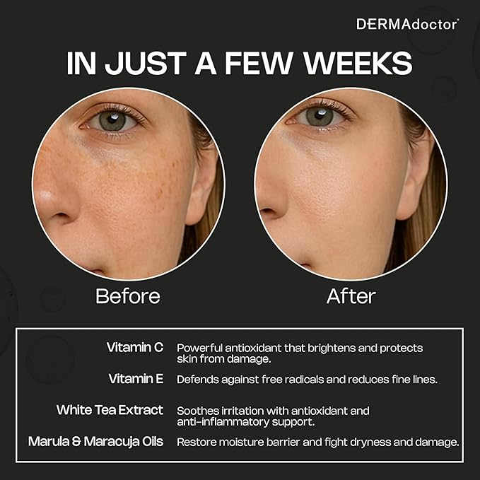 DERMAdoctor Vitamin C Oil for Face – Night Toner, Hydrating 20% Vitamin C Face Oil for Women Anti Aging with Vitamin E, Ferulic Acid & Marula Oils, Dermatologist Formulated, 1 Oz