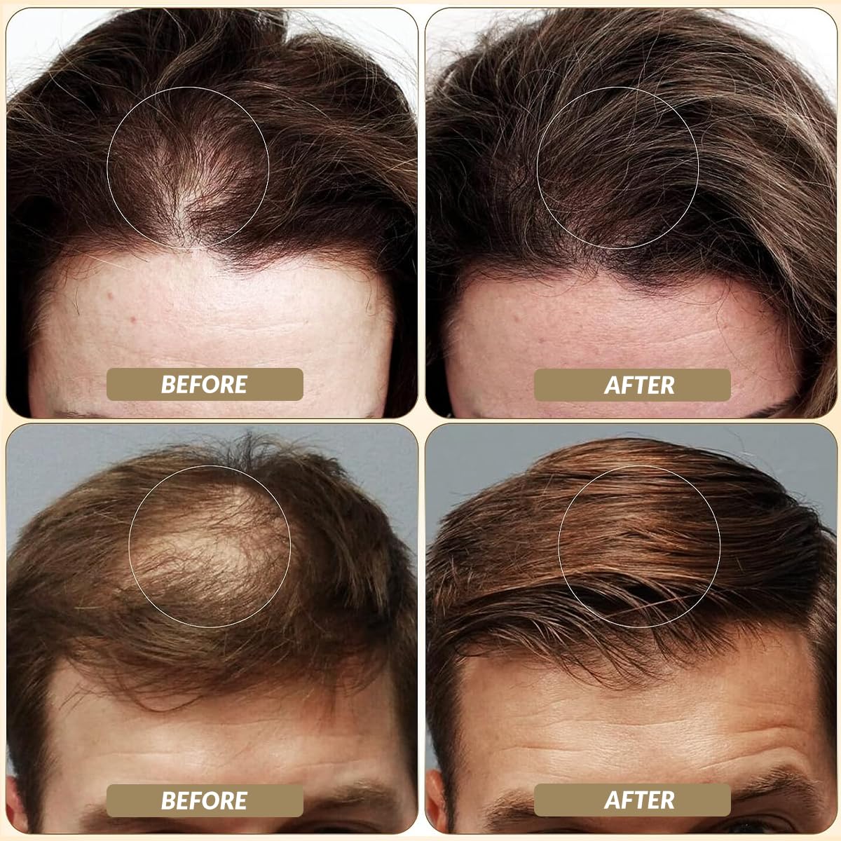 SOVONCARE Hair Fibers for Thinning Hair Gray, Hair Building Fibers for Bald Spots Undetectable & Natural, Conceals Hair Loss Fill In Fine, Hair Powder Hair Thicker Instantly for Women & Men 28g