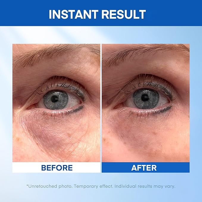 Instant Under Eye Lift Serum - Reduces Eye Bags, Wrinkles, Puffy Eyes, Dark Circles & Crow’s Feet in Minutes - Advanced Firming Polysaccharide Formula for Mature Skin - 20 mL