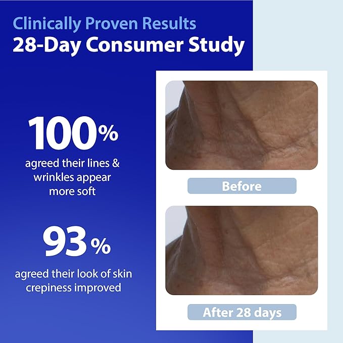 Dr. Denese Neck Firming and Tightening Serum Roll-On 2 oz – Vitamin C and Peptide Formula with Retinoate for Smooth Radiant Skin and Refined Jawline – Improves Elasticity, Hydration, and Definition