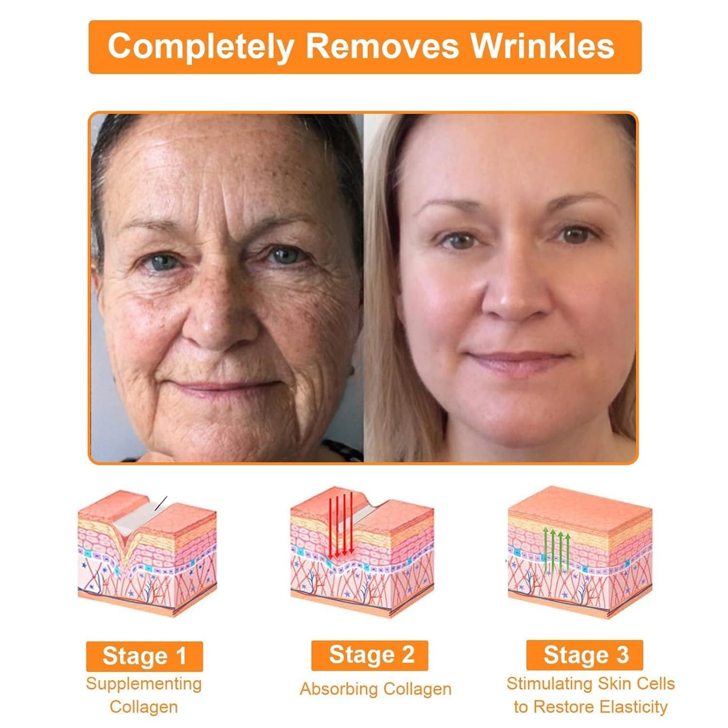 Bee Venom Comprehensive Bee Cream,2025 Professional Treatment Cream Wrinkle Removal Anti-Aging Moisturizing,Effective In Reducing Skin Blemishes (2PCS)