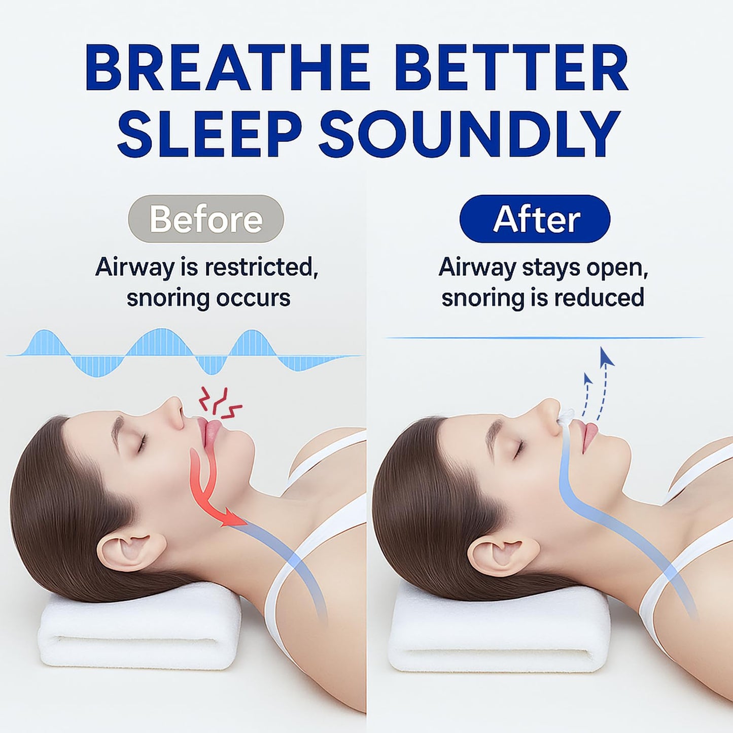 Anti Snoring Devices, Adjustable Snore Stopper for Men and Women, Snoring Solution, Individually Packaged & Reusable – 4 Pack