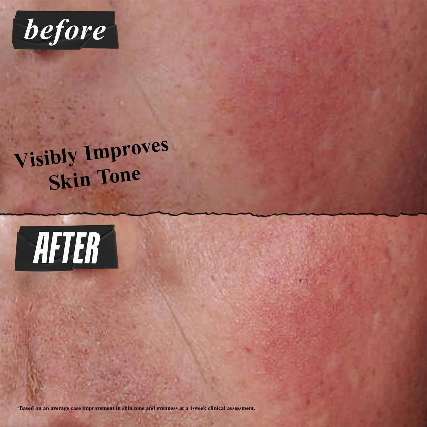 Kiehl's Ultra Facial Advanced Repair Barrier Cream, Intensive Treatment Relieves Dry + Sensitive Skin, Rapidly Reduces Redness a