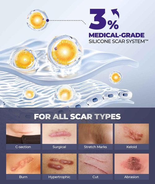 Silicone Scar Cream with 6.7% Active Ingredients, Scar Gel Visible in 2 Weeks, Moisturizing Scar Removal Clinically Show for Surgical, C-Section, Keloid, Acne & Burn Scars, Stretch Mark Cream(55ML)