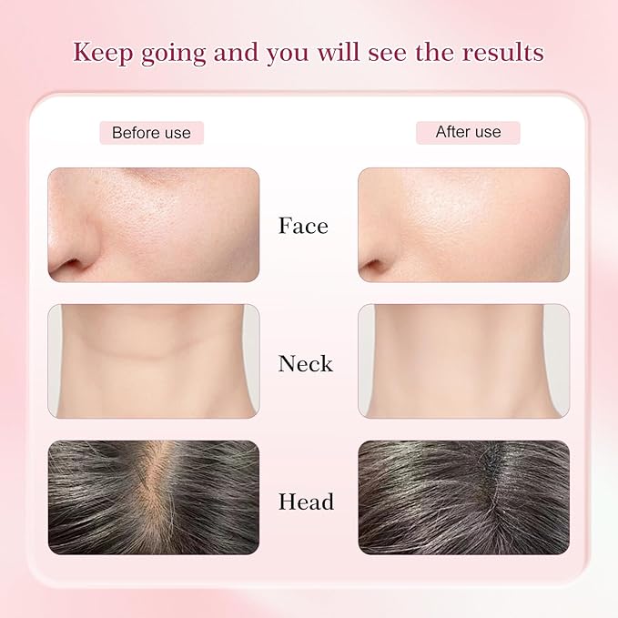 Multi-Functional-Red-Light-Therapy-for-Face and Neck-Eye-Head Massager,7 Colors Skin Rejuvenation Lifting Facial Massager for Toning,Glow Boost，Wrinkle&Dark Circle Reducer (Pink)