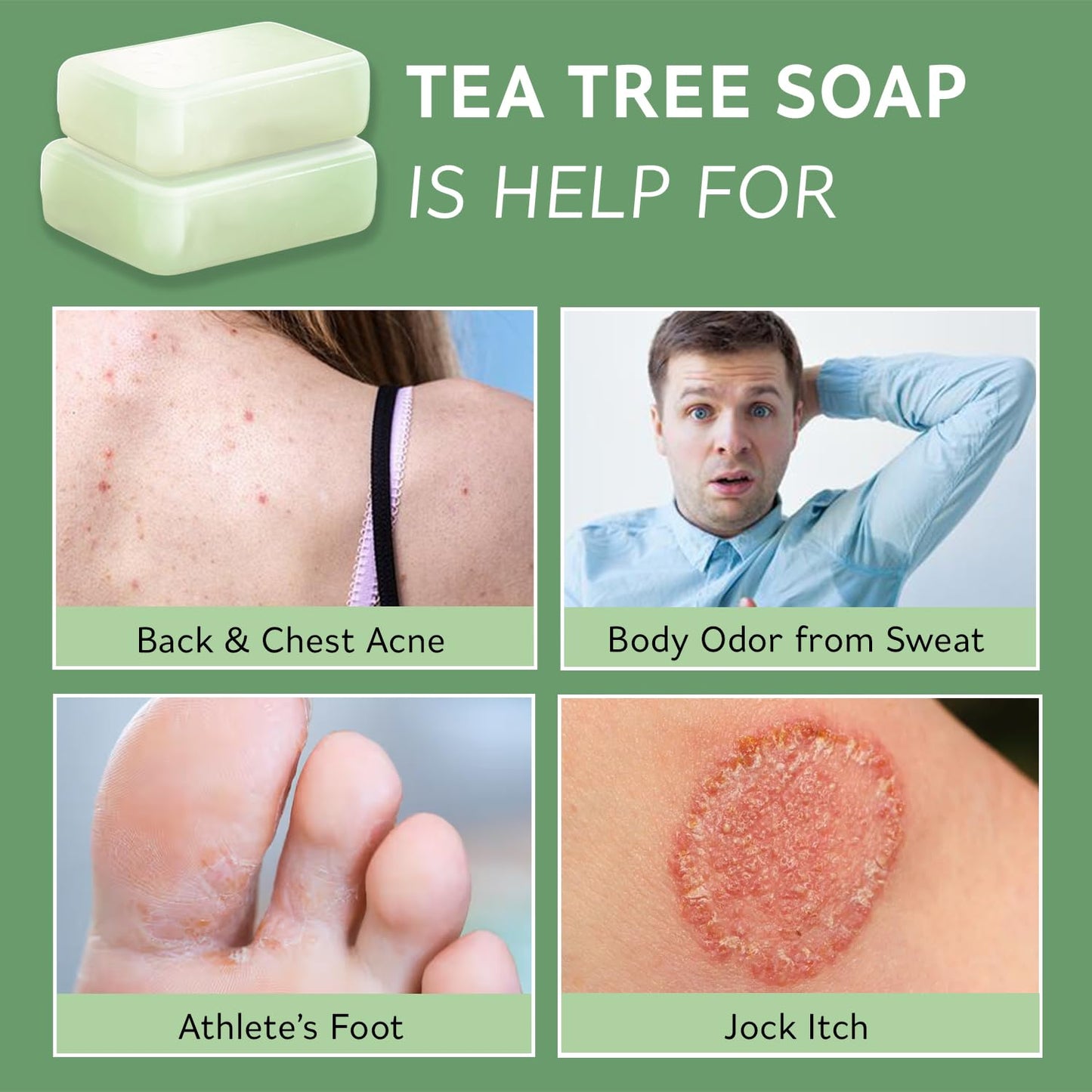 PHARMBANNER Tea Tree Antifungal Soap Bar - Body Wash for Face & Body Acne, Folliculitis, Jock Itch, Ringworm, Athletes Foot, Bod