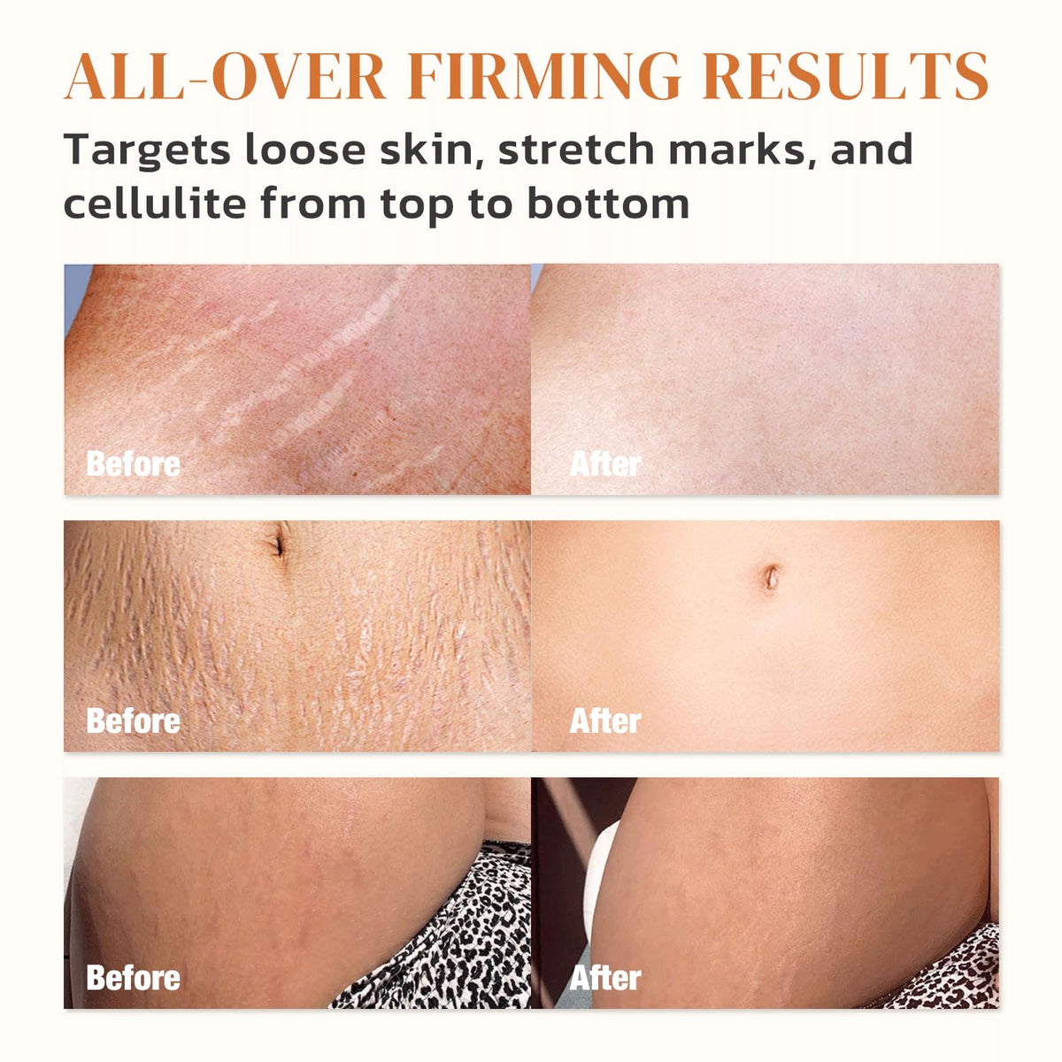 Green Luxe B Flat Belly Firming Cream - Skin Tightening Cream for Body: Lift & Tone Tummy, Thighs, Booty & Arms - Stretch Mark &