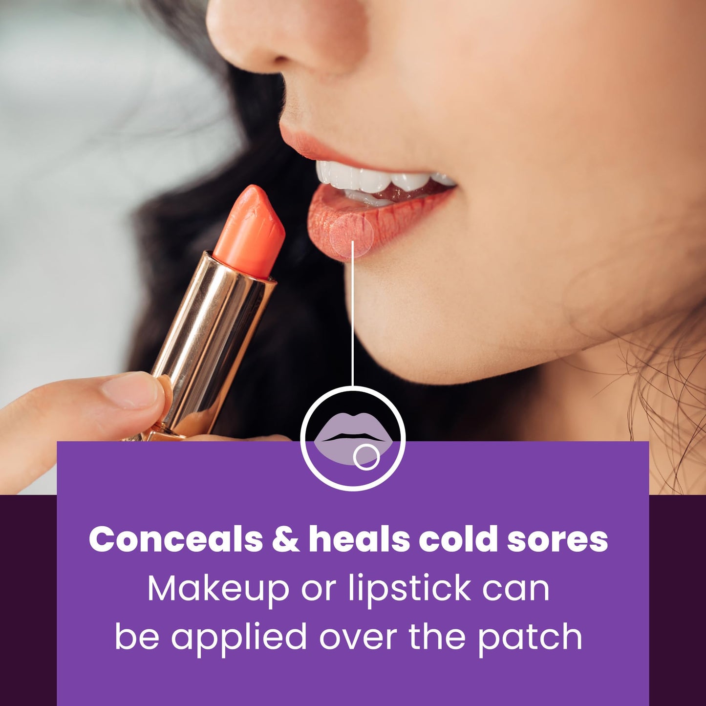 Mederma Cold Sore Discreet Patch - Hydrocolloid Gel for Redness & Swelling, Conceals Cold Sores (30 Patches)