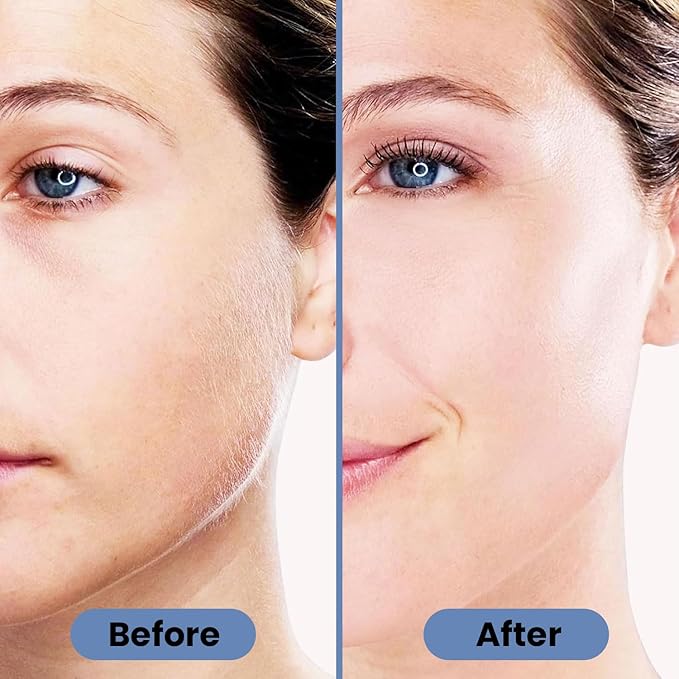 Facial Hair Remover for Women – Electric Face Razor with Light, Hair Removal for Upper Lip, Chin & Cheeks – Color Blue