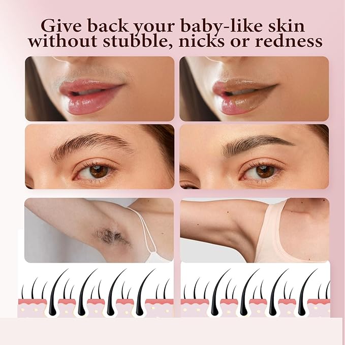 Gurelax Replacement Heads for Flawless Finishing Touch Facial Hair Remover, Gen 3 Replacement Blades for Women,18K Gold Replacement Blades Refill (Just fit for Gen3 Device)
