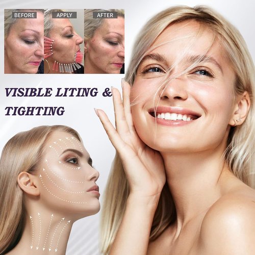 Habodd PCL Threads for Face Whole Body Lift, 360R Bi-Direction 4D Cog Type 10PCS (21G60MM) PCL Cog Thread Big V Line for Body Cheek Jaw Lift