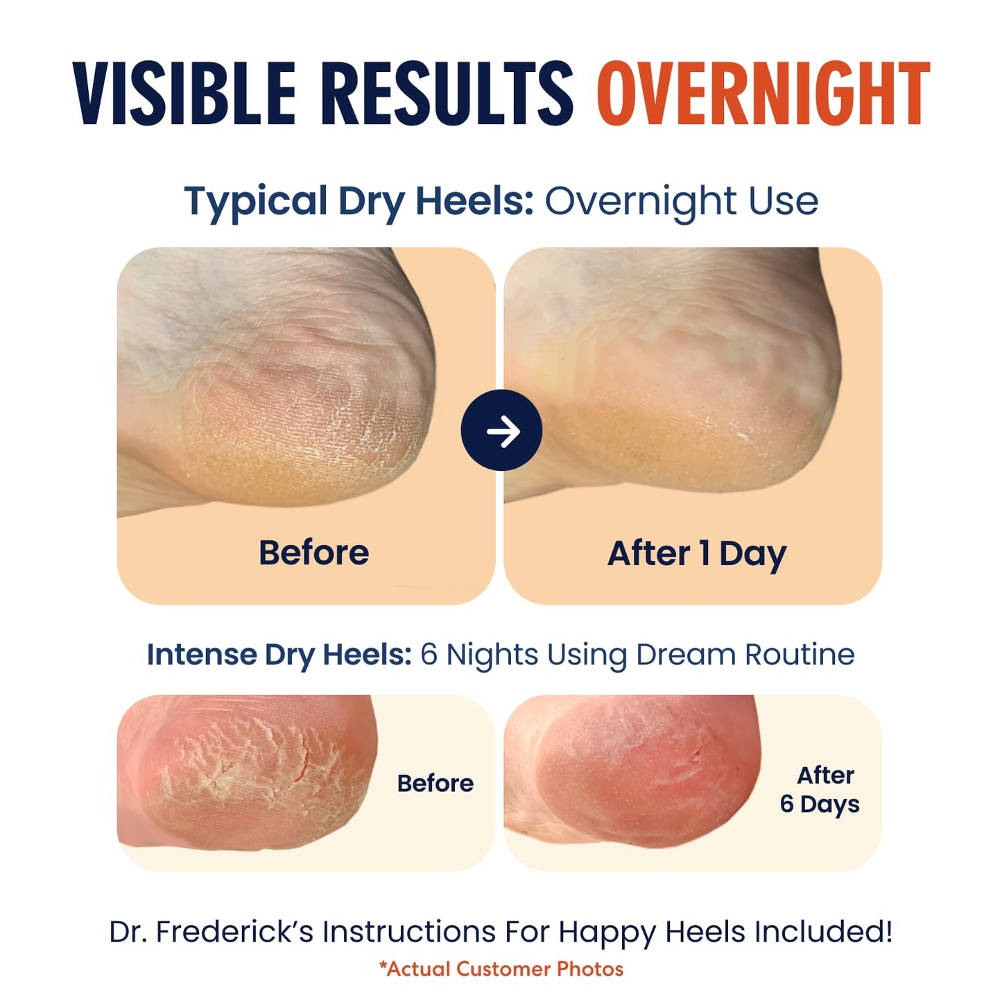Dr. Frederick's Original Moisturizing Heel Socks for Cracked Heel Treatment - 6 Pairs - Socks for Dry Feet - Cracked Skin Repair