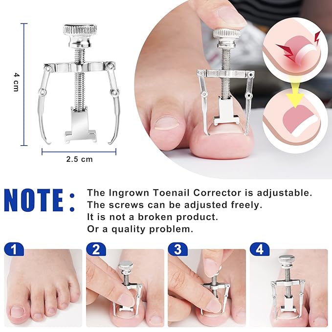 JTIEO Ingrown Toenail Tool 7PCS Upgraded Toenail Clippers Ingrown Toenail Treatment Pedicure Tools Professional Tool Set for Ingrown & Thick Nail Stainless Steel Ingrown Toenail Removal Kit