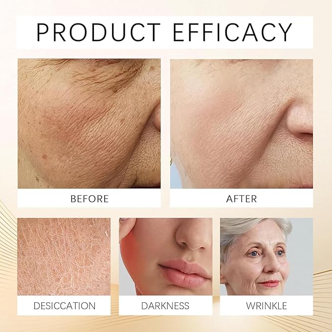 New Upgrade Perfection Eye Tightener, Perfection Instant Eye Tightener,Perfection Primer Tightener, Reduces The Look of Under eye Bags, Dark Circles & Puffiness, Anti-Aging Fine Lines (1)