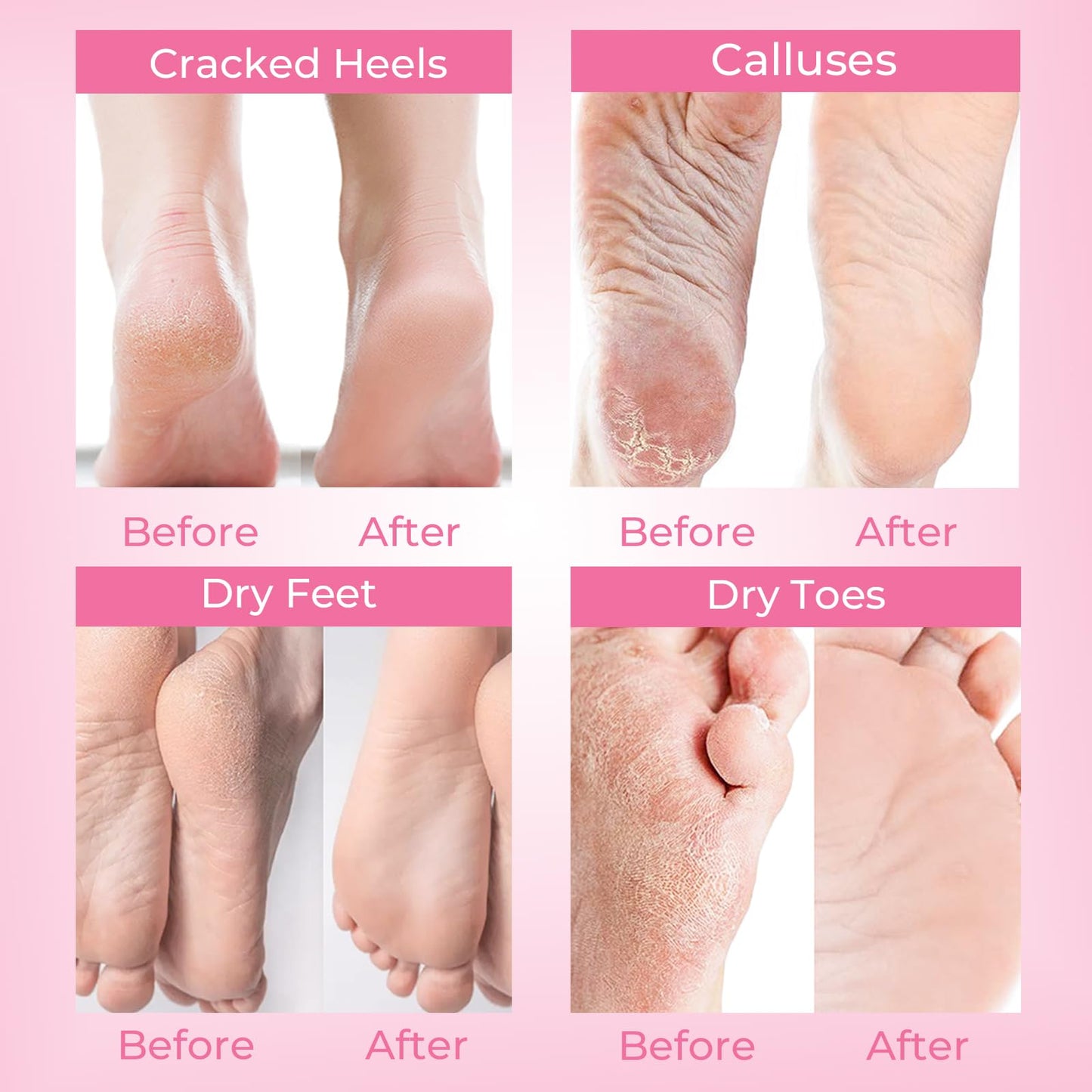 SAISZE Foot Peeling Mask, 4 Pairs, Lavender, Natural Exfoliating Foot Mask for Dry Cracked Feet, Dead Skin Callus Remover for Ba