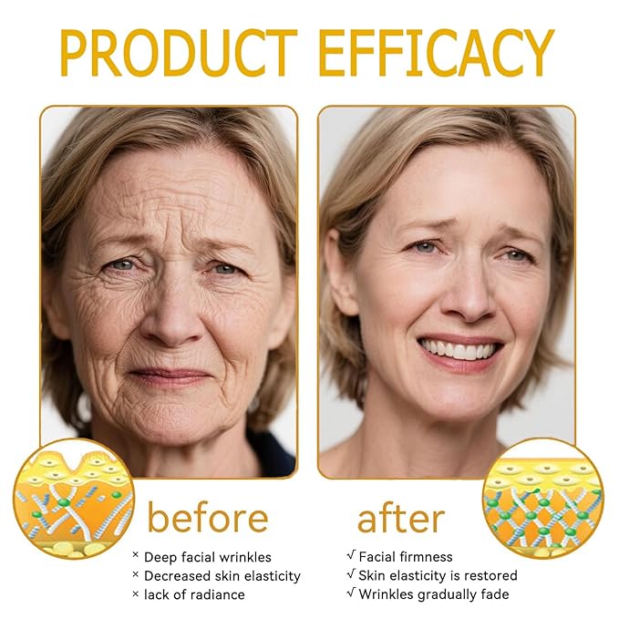 Bee Venom Comprehensive Cream, Bee Venom Skin Treatment Cream, All-in-One, Lifting & Firming, Anti-Aging Moisturizing, Effectively reduces all types of skin blemishes