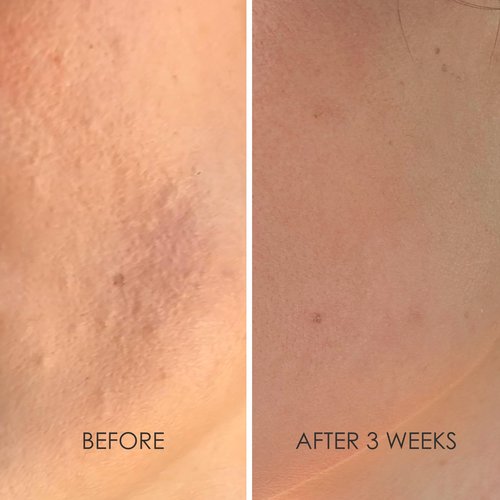 REFLEKT 4 Smoothing Squalane Eye & Lip Treatment Cream