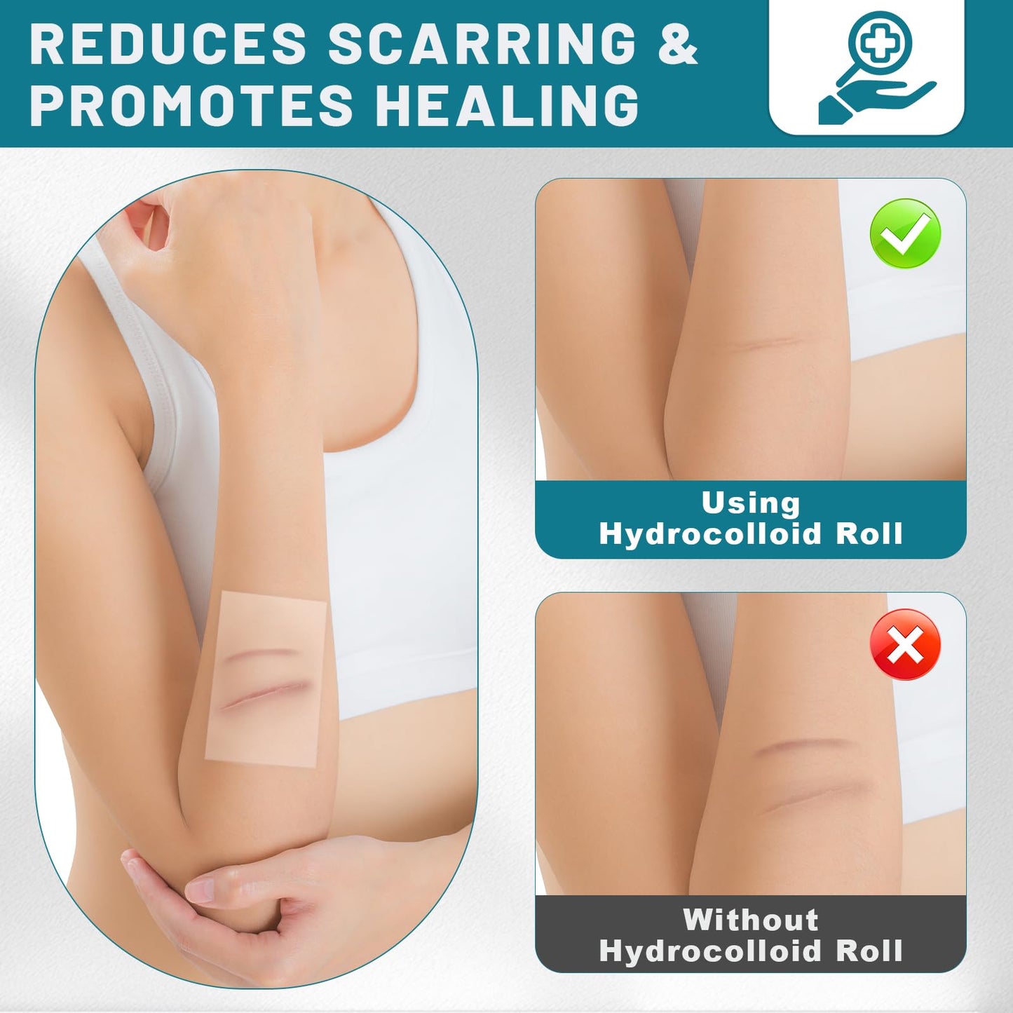 WUYUAN Hydrocolloid Roll for Wound Care, Hydrocolloid Bandages with Self-Adhesive, Extra Large Hydrocolloid Patch Bandages Cut-to-Size, Ultra Absorbent, Waterproof First Aid Kit Essential, 2in*6.6ft