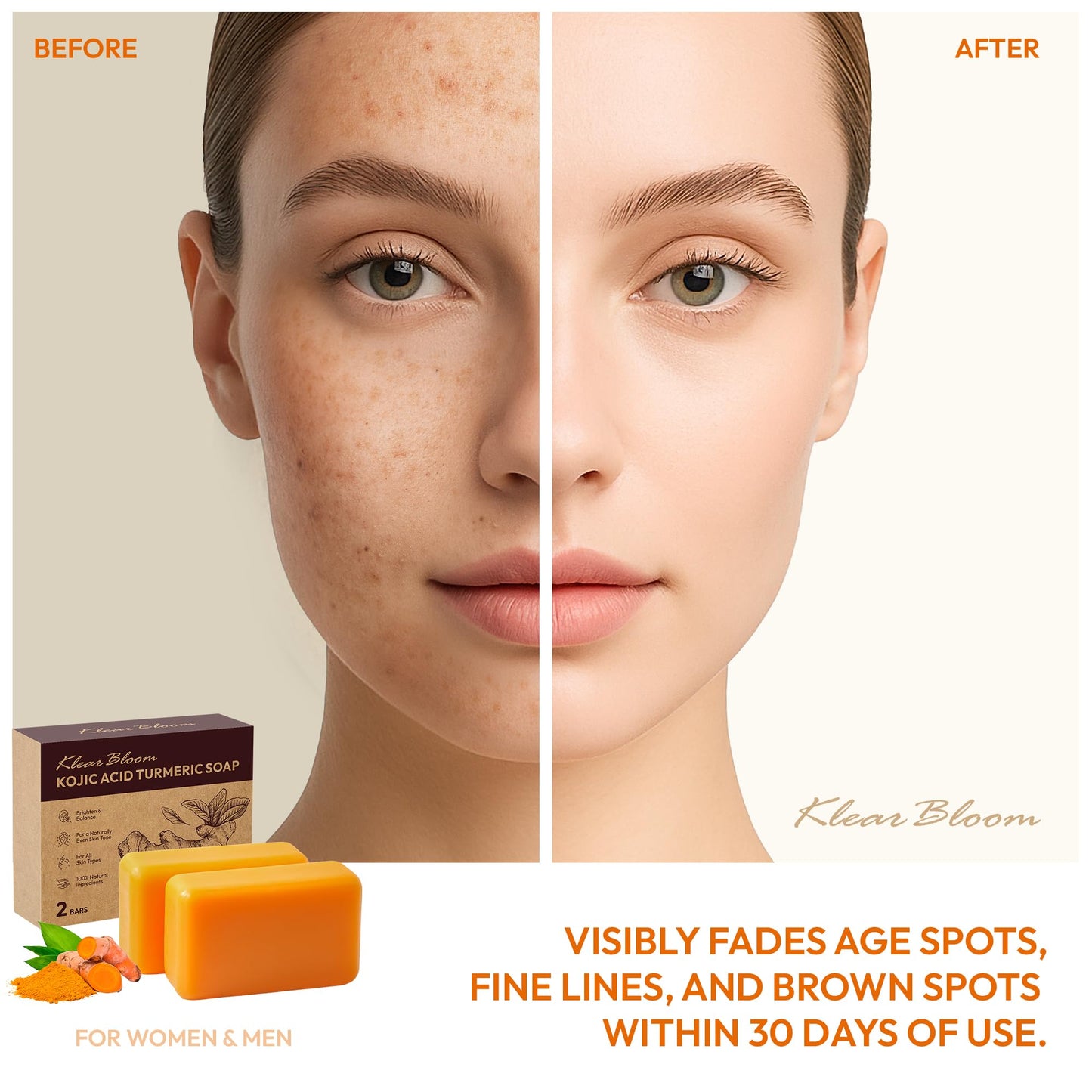 KlearBloom Kojic Acid Soap, Turmeric Soap Bar for Dark Spots with Collagen, Vitamin E, Retinol, Hyaluronic Acid, Shea Butter - 1