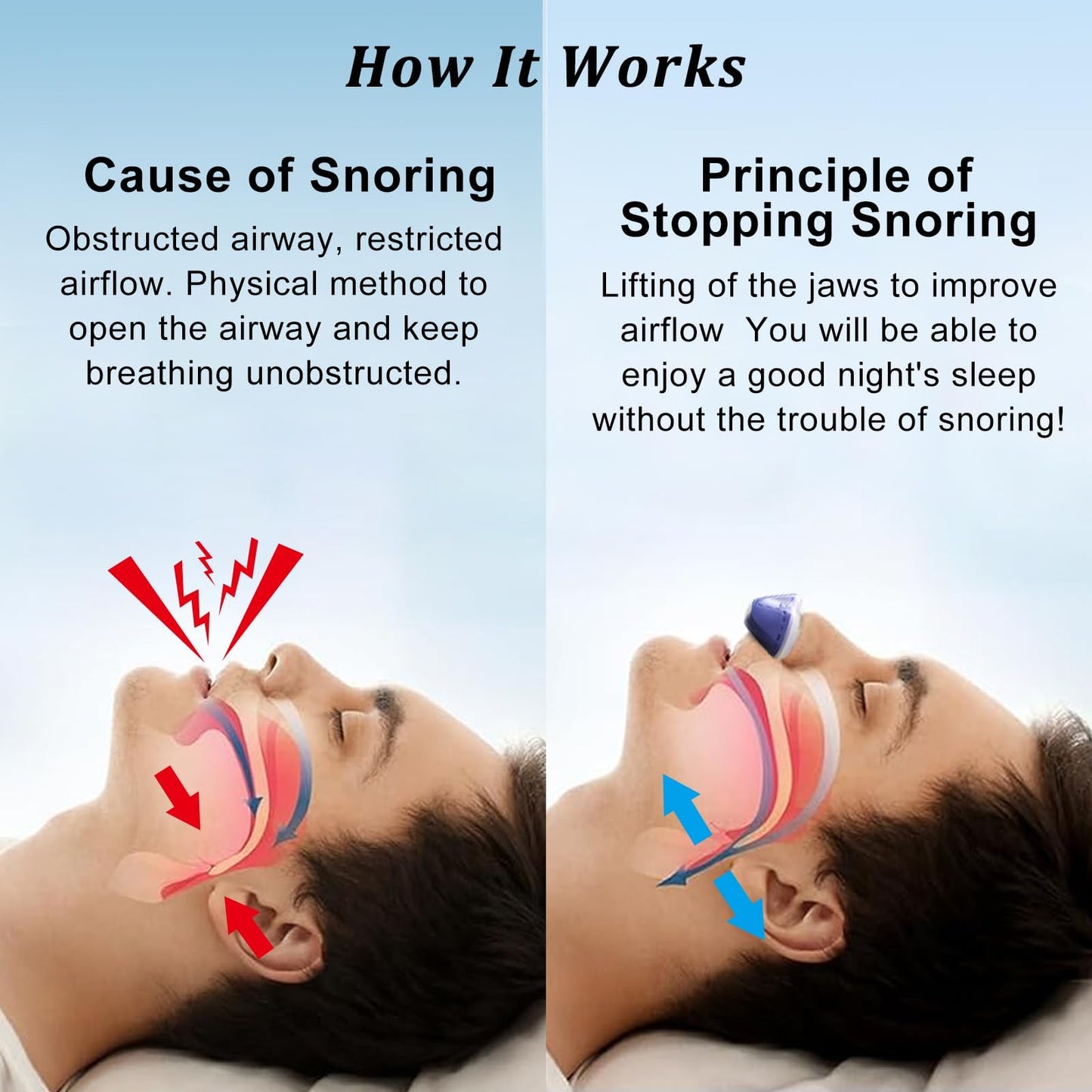 Anti Snoring Devices, Electric Anti Snoring Device, Effective Snoring Prevention, Sleep Apnea Devices for Men and Women, Adjustable Wind Speed, Suitable for All Nose Shapes, Blue AA7