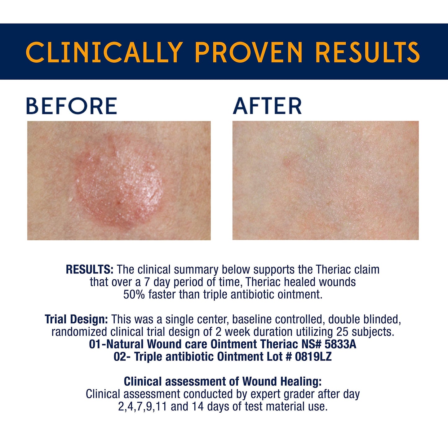 Theriac Advanced Manuka Honey Healing Ointment – Clinically Shown to Heal 50% Faster Than Triple Antibiotic/Ideal for Minor Cuts, Scrapes, and Burns / (0.5 Oz)