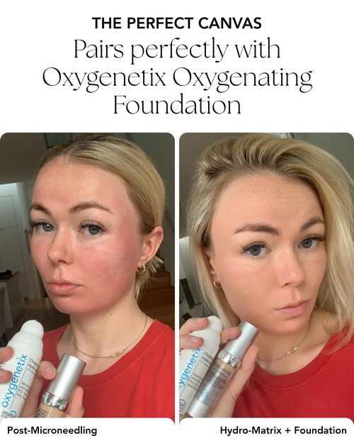 Oxygenetix Oxygenating Hydro-Matrix (1.7oz) | Lightweight Aloe-Based Face Moisturizer with Hyaluronic Acid for Sensitive, Dry, or Compromised Skin