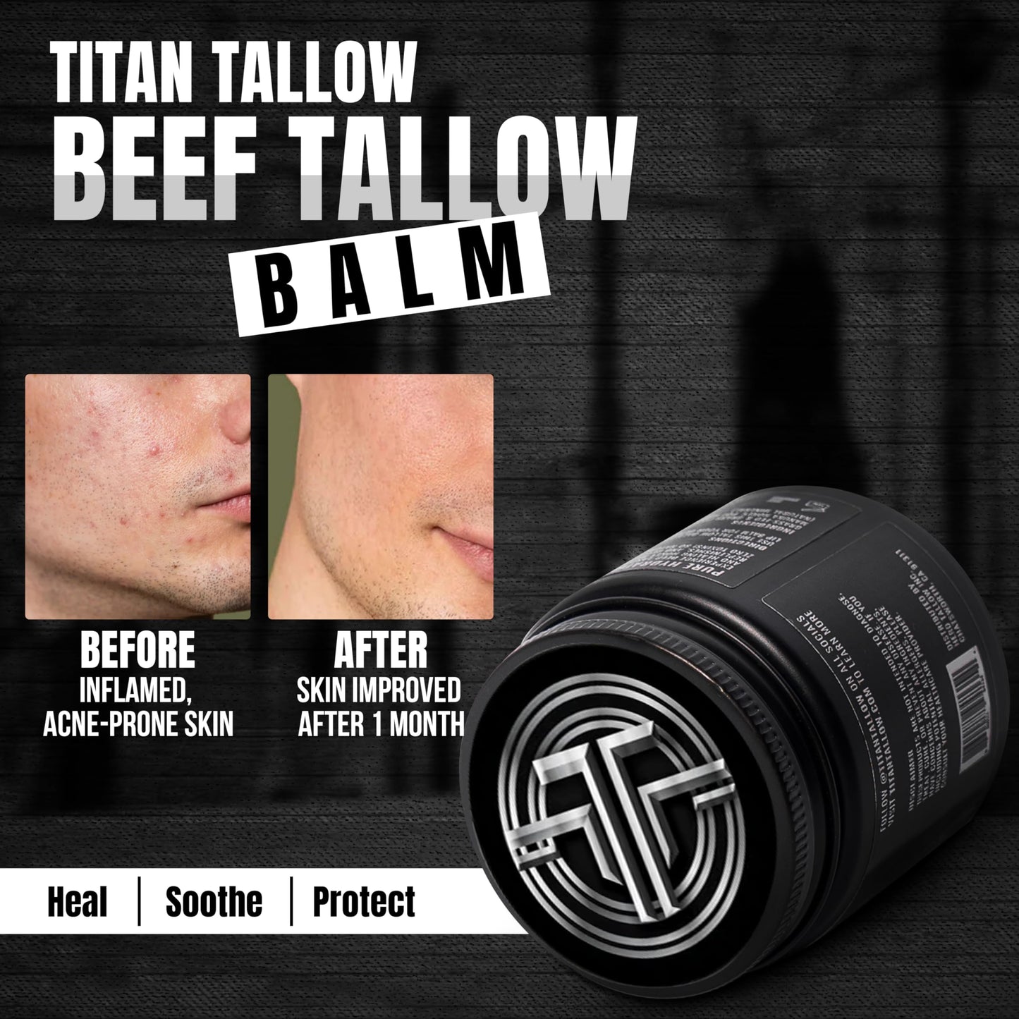 Whipped Beef Tallow Balm Magnesium Moisturizer - 100% Organic Grass-Fed & Grass-Finished Tallow with Manuka Honey for Skin Care