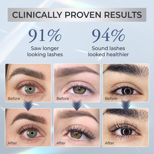 Abera Misan Eyelash Growth Serum (Upgrade Version) - Natural Lash Booster and Lash Enhancer, Regenerating and Nourishing Lashes Longer and Thicker (B. Set of 2)
