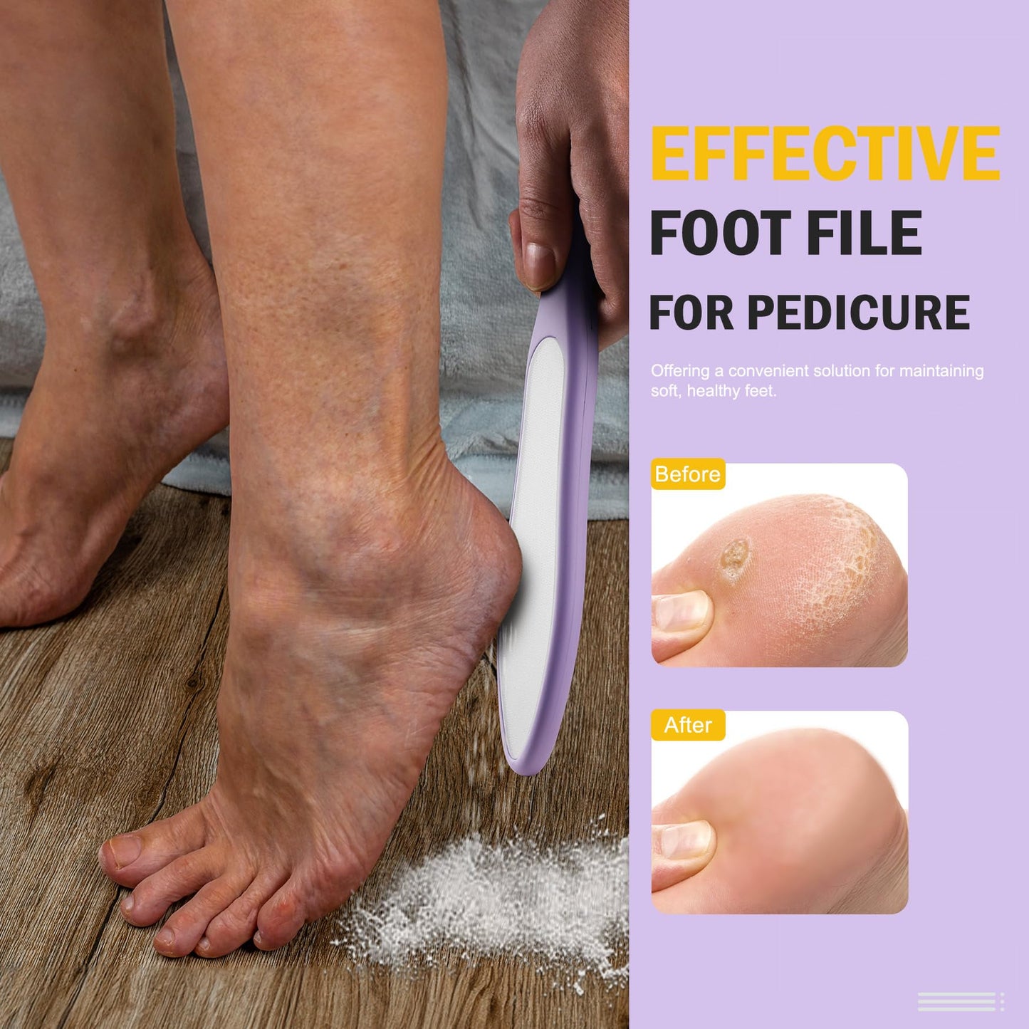 FVION Double-Sided Nano Glass Foot File for Callus Remover - Highly Effective Hard and Dead Skin Remover for Cracked Heels and D