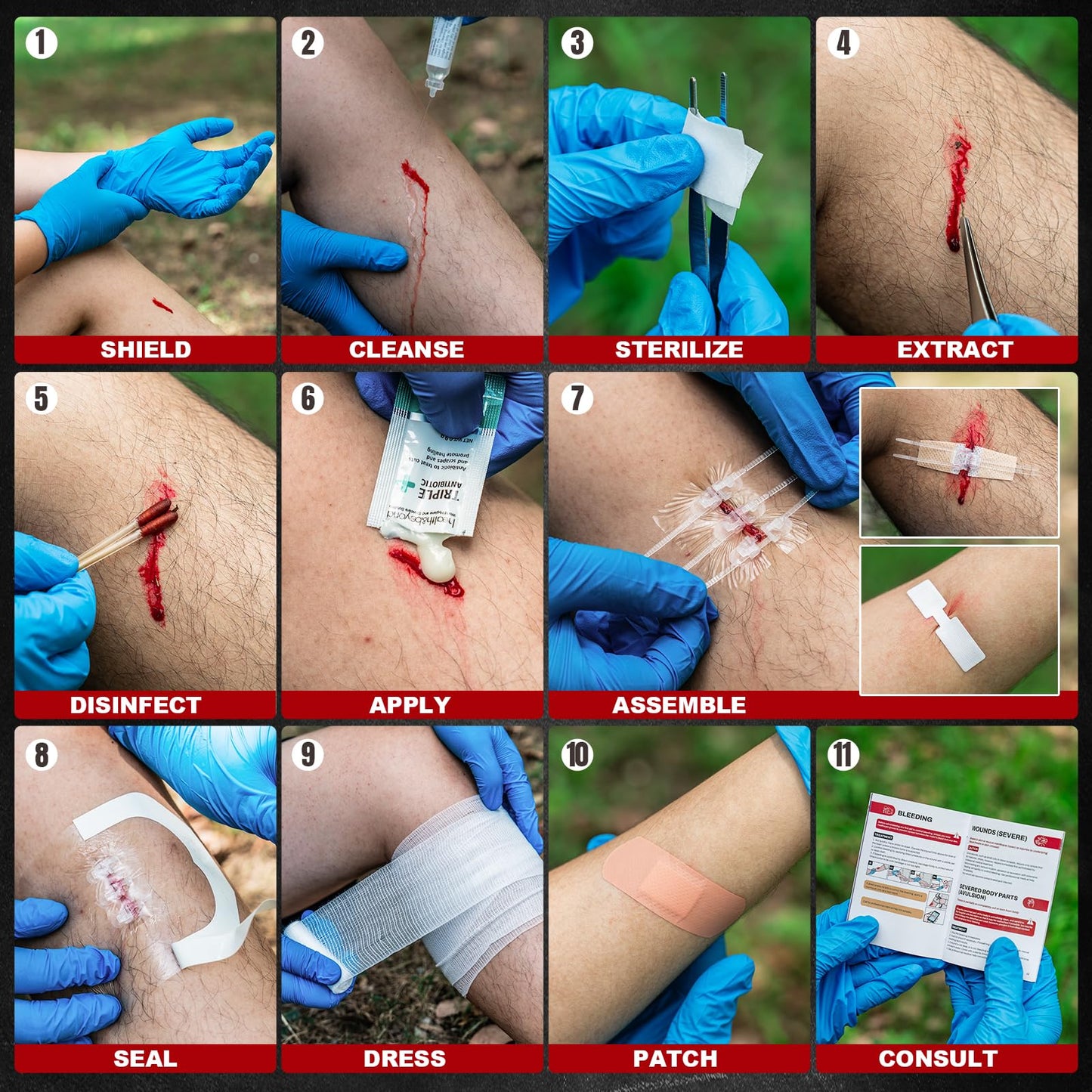 RHINO RESCUE Wound Closure Kit, 3 Types Butterfly Bandages with Bandages, Triple Antibiotic Ointment, Wound Closure Strips, Stitchless & Painless Stitch Zip Laceration Closure First Aid Kit