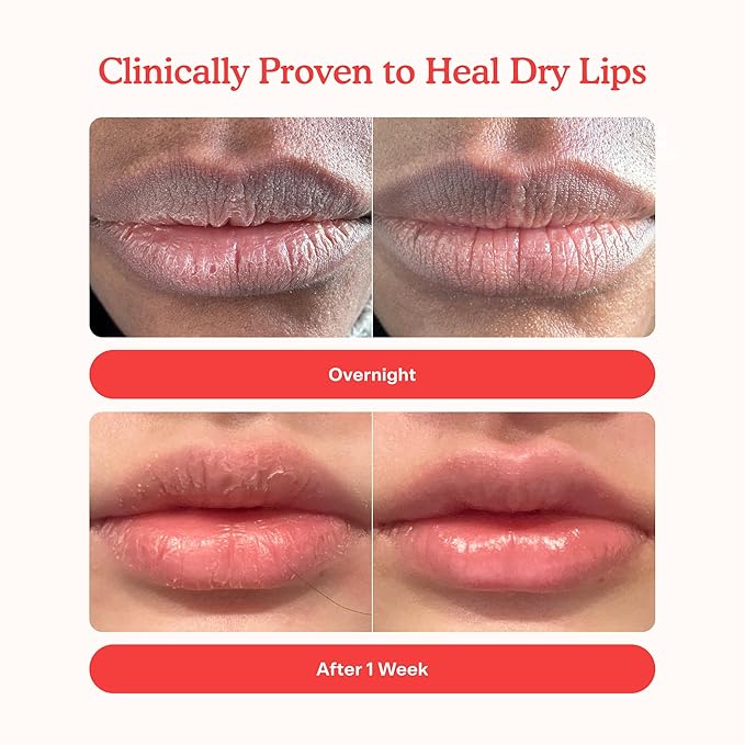 Tower 28 LipSoftie Hydrating Lip Treatment Balm, Moisturizing Lip Mask for Chapped Lips - SOS Vanilla Flavor, Clear Gloss