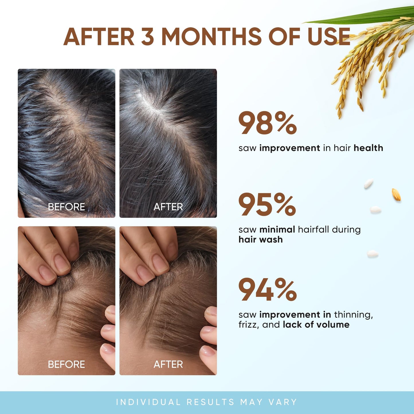 Svvimer Rice Water Hair Growth Shampoo - Thickening Shampoo with Biotin for Hair Loss and Thinning Hair