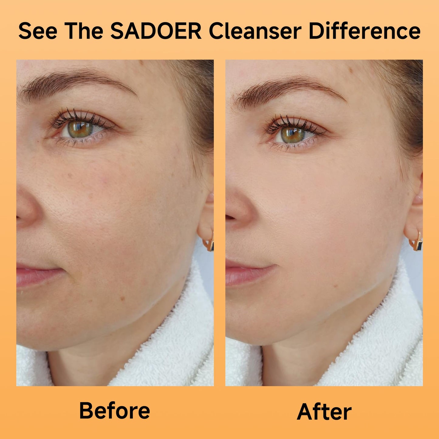 5X Vitamin C Face Cleanser 100g(2 Bottle) ,SADOER Facial cleanser Niacinamide & Hyaluronic Acid, Gentle Pore Refining Daily Wash