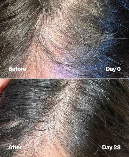 SickScience PowerCycle Exosome Hair Growth Serum - Clinically Advanced Scalp Treatment for Thinning Hair, Hair Loss Prevention & Regrowth - Lightweight Formula for Women & Men, Without Minoxidil, 60mL