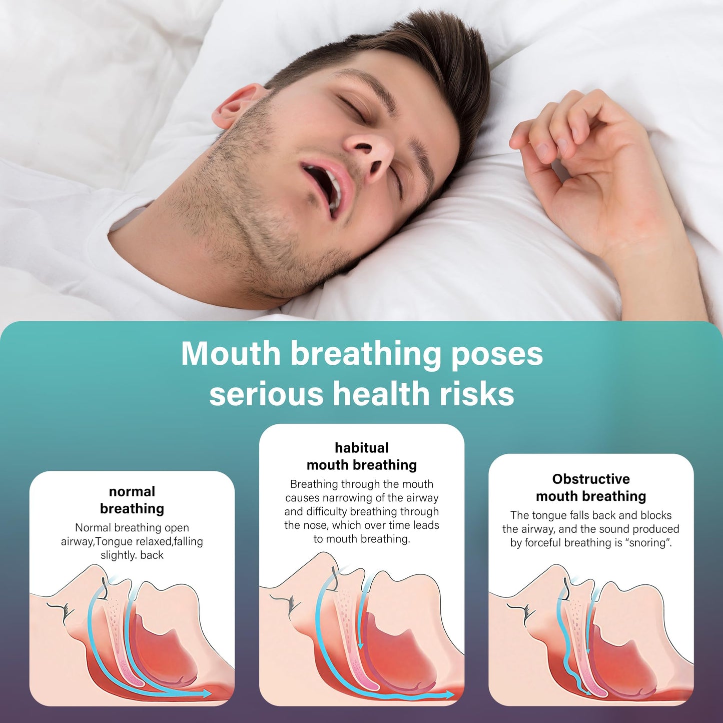 30pcs Mouth Breathing Correction Patch, Children's Closed Mouth Patch, Adult Anti-snoring, Closed Mouth Patch, Improve Mouth Breathing Facial Problems (Large（16 years and over）)