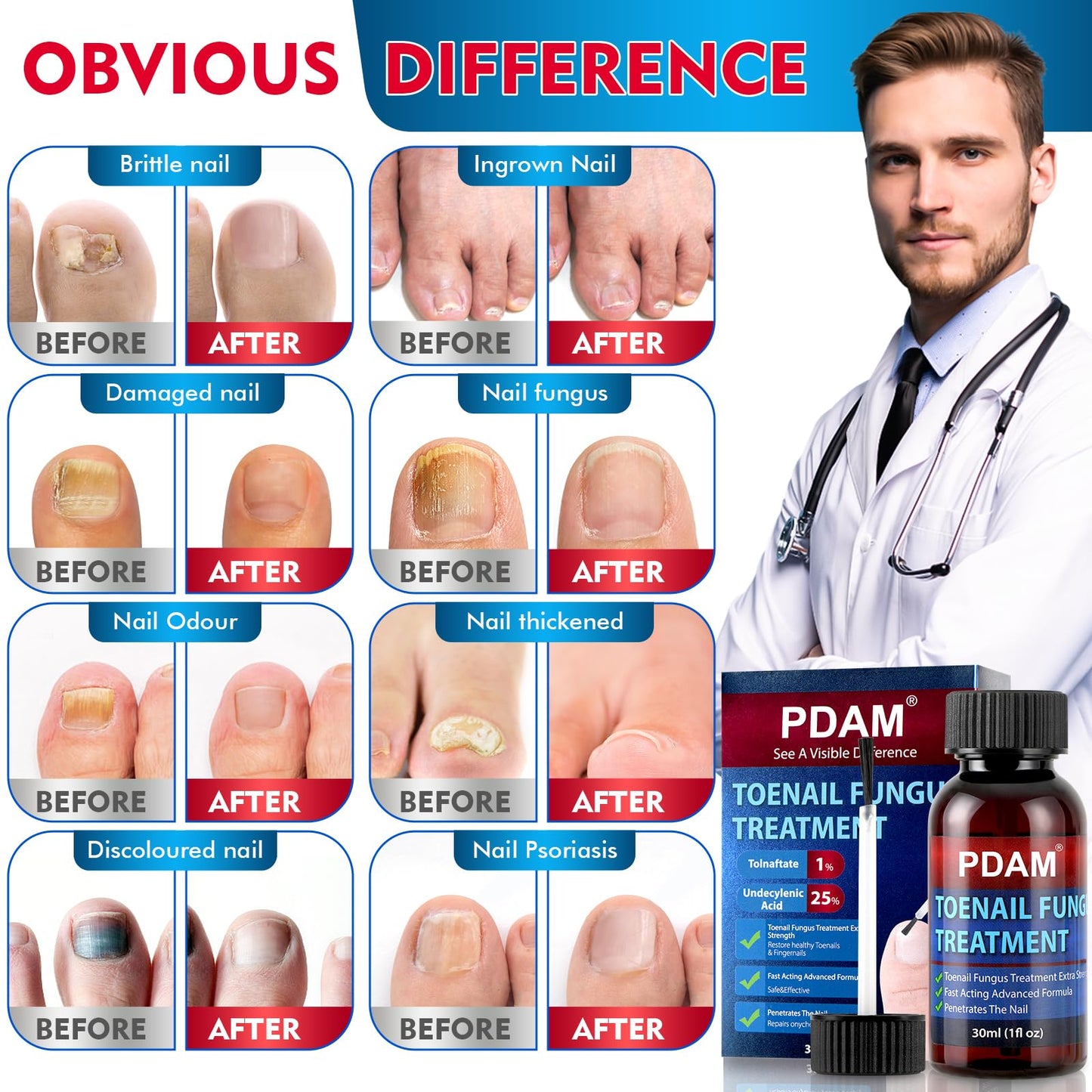 Toenail Fungus Treatment Extra Strength - Toe Nail Fungus Treatments for Thick, Nail Strengthener and Growth, Nail Fungus Treatm